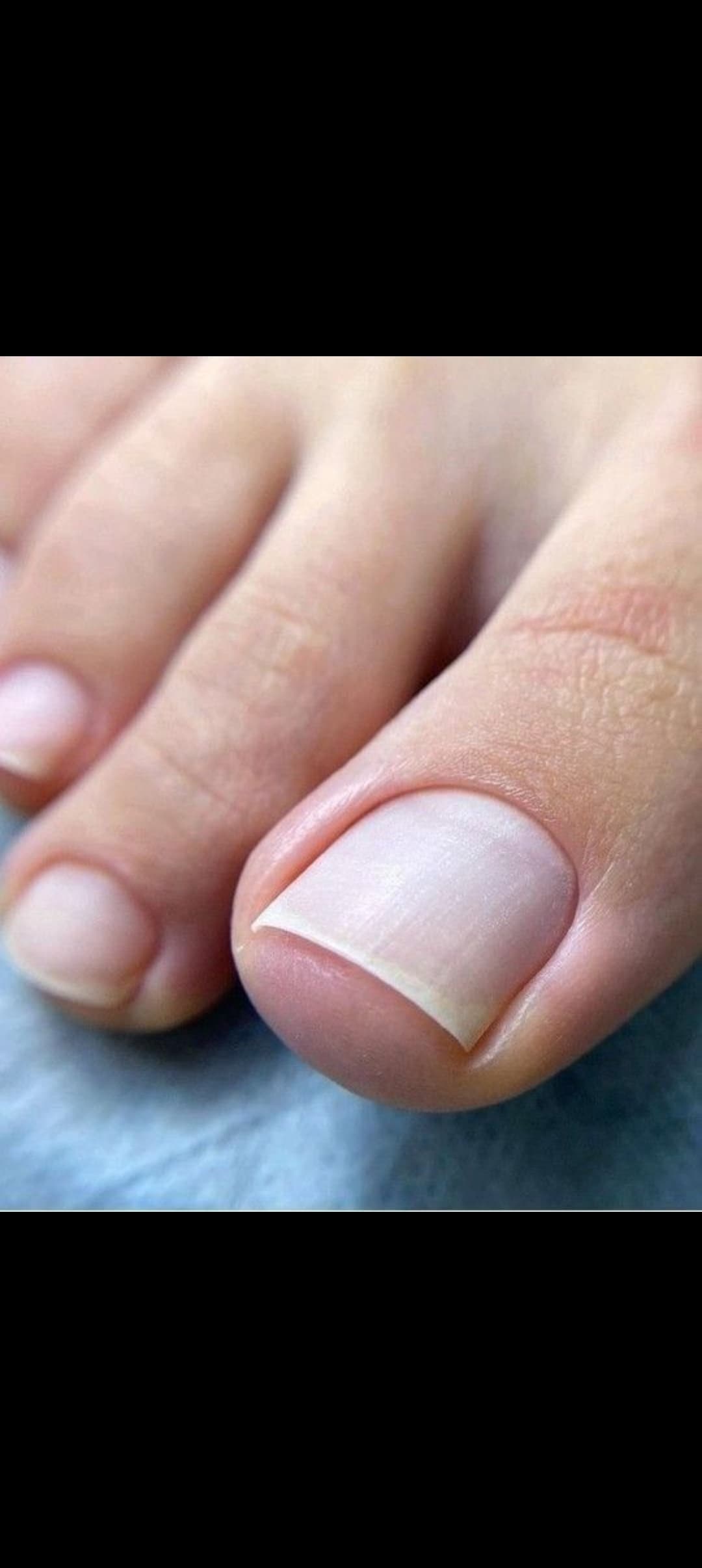 Pedicura Técnica